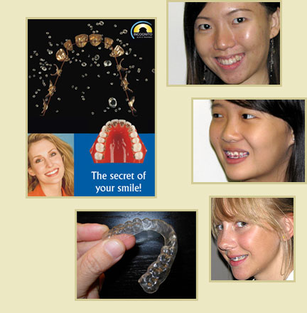 dentist, invisible braces, wisdom tooth surgery, teeth implant, dental clinic