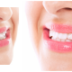 dentist, invisible braces, wisdom tooth surgery, teeth implant, dental clinic